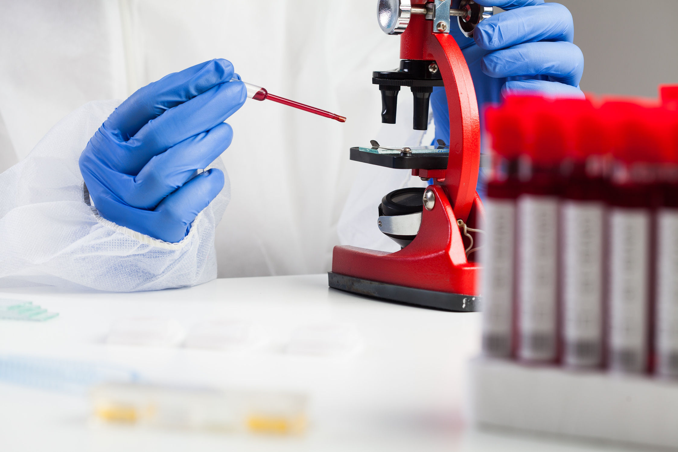 Medical technologist or lab scientist examining Coronavirus patient specimen